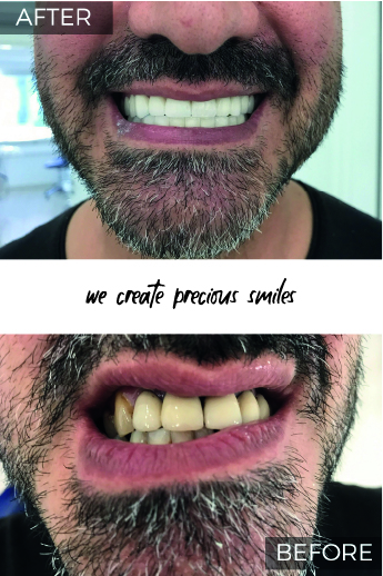 Artboard 79 copy 2@3x-100