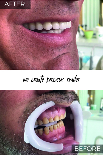 Artboard 79 copy 3@3x-100