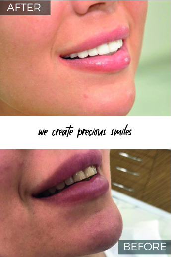 Artboard 79 copy 4@3x-100