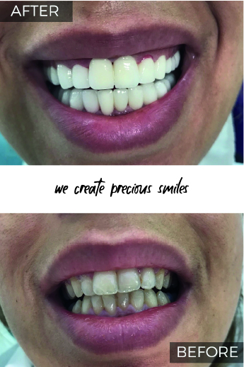 Artboard 79 copy 5@3x-100