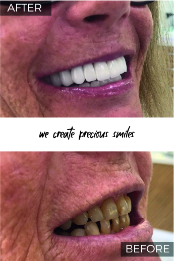 Artboard 79 copy 6@3x-100