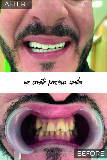 Artboard 79 copy@3x-100